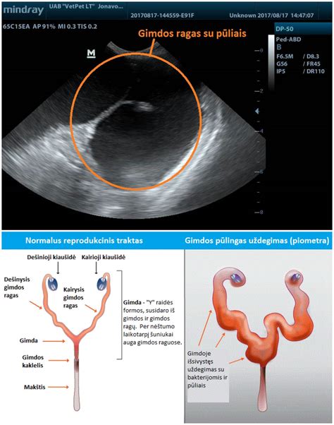 Ultragarsinio tyrimo vaizdas, rodantis placentos vietą gimdoje