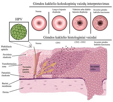 Infografika: Gimdos susitraukimų priežastys