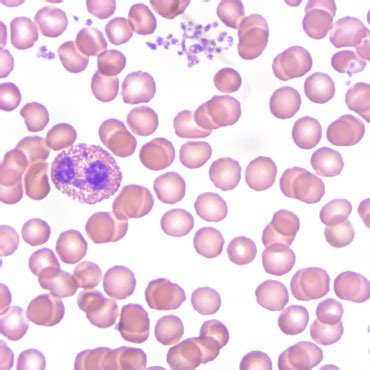 Blastocistos mikroskopinis vaizdas su matoma tuščia ertme (blastoceliu)