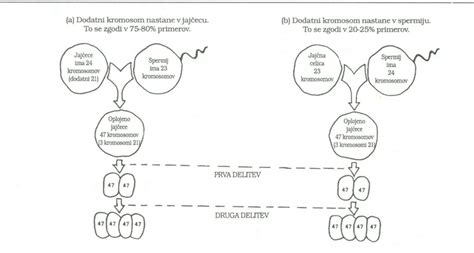 vaisius su Trisomija 21