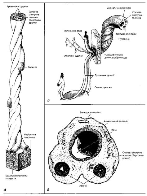 Схема нормальної будови пуповини з двома артеріями та однією веною