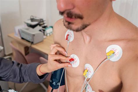 EKG aparato nuotrauka
