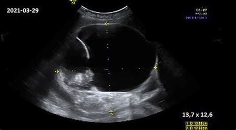 Vaisiaus širdies ultragarsinis vaizdas