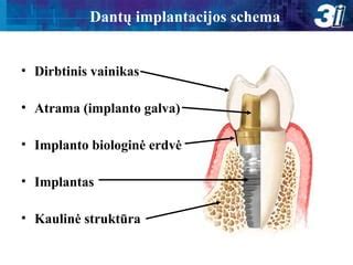 Implantacijos kraujavimo schema