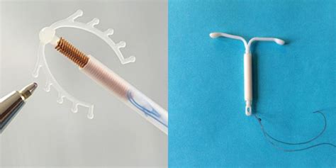 Schema, vaizduojanti hormoninės ir varinės spiralės veikimo principus