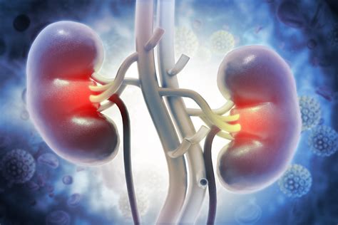 Inkstų akmenligės simptomai