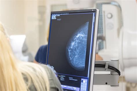 Krūties ultragarsinio tyrimo vaizdas