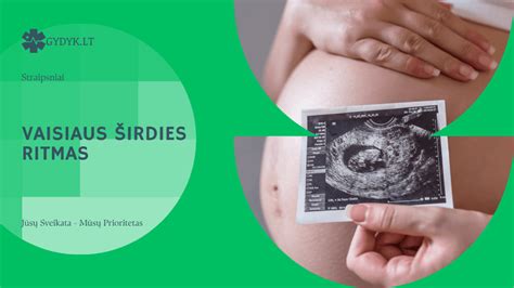 Vaisiaus širdies ritmo kreivė nėštumo metu