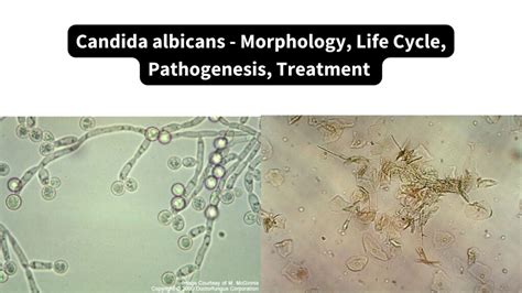 Candida albicans mikroskopinis vaizdas