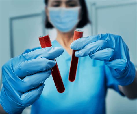 Žemėlapis, rodantis lytiškai plintančių ligų paplitimą Europoje