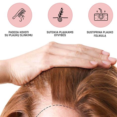 Vyro galvos schema su plaukų slinkimo etapais