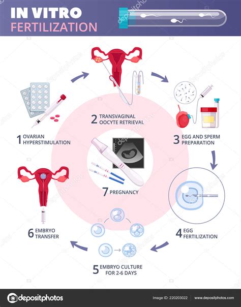 Diagrama, iliustruojanti IVF procedūros etapus