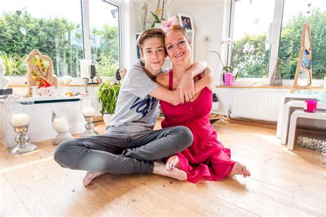 Alison Lapper tapo burna