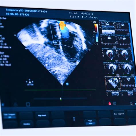 Ultragarso vaizdas, rodantis nėštumo maišelį