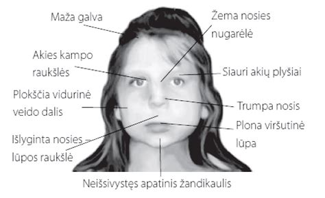 Veido bruožų palyginimas