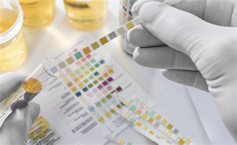 šlapimo tyrimo juostelė ir analizatorius