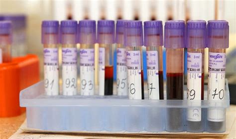 Laboratoriniai kraujo tyrimo mėgintuvėliai