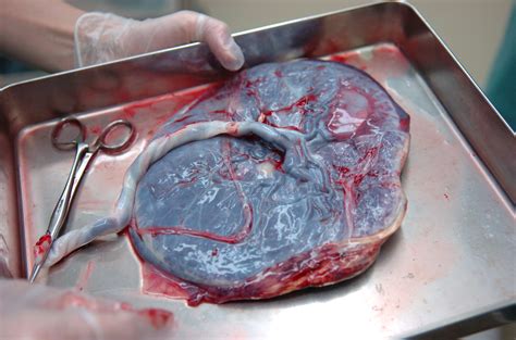 Placenta