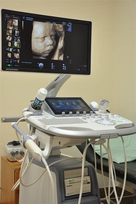 Ginekologinis echoskopas