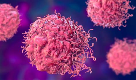 Sėklidžių vėžio ląstelės