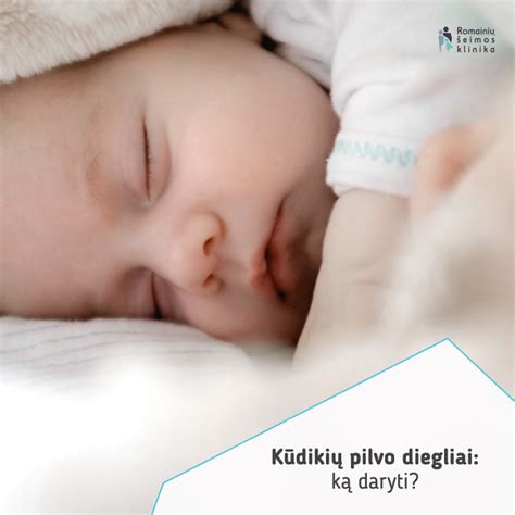 kūdikio pilvo diegliai