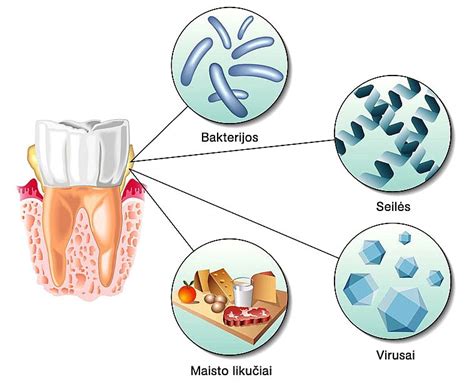 Vaizdinis pavaizdavimas, kaip plinta kokliušo bakterijos