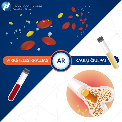 Virkštelės kraujo surinkimas ir kamieninių ląstelių išskyrimas