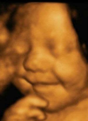 3D ultragarso vaizdas, kuriame matomas vaisiaus veidas