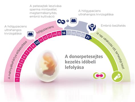 Infografika, iliustruojanti IVF procedūros etapus