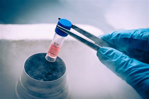 Cryopreservation of gametes and embryos