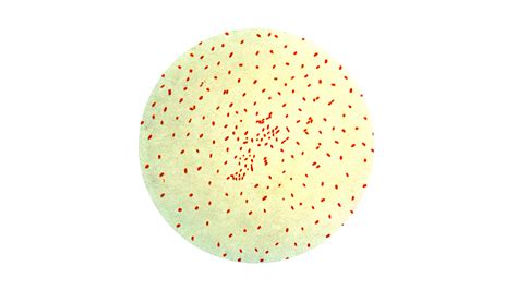 Bordetella pertussis bakterijos mikroskopinis vaizdas