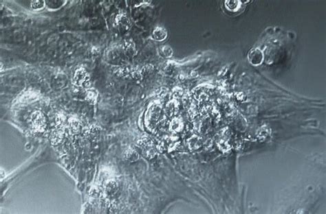 Žmogaus kamieninių ląstelių mikroskopinis vaizdas