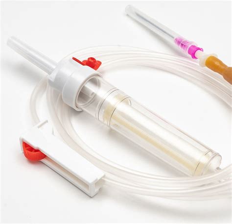 Schematinė dvynukų transfuzijos iliustracija