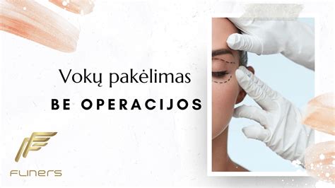 Schematinis IUI procedūros vaizdas