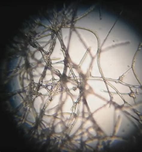 vizualizacija osiurų po mikroskopu