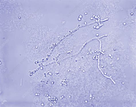 Candida albicans grybelis po mikroskopu