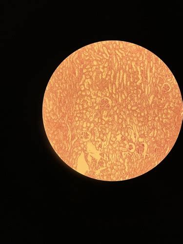 Spermatozoidų ir kiaušialąstės mikroskopinis vaizdas