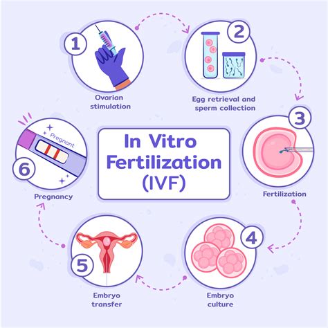 In Vitro Fertilizacija (IVF) procedūros schema
