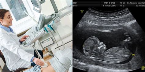 Echoskopijos vaizdas su vaisiumi