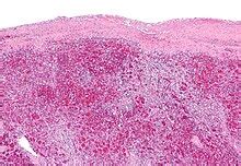 Žmogaus plaučių audinio mikroskopinis vaizdas