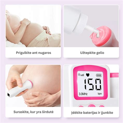 schematinis vaisiaus ir motinos širdies ritmo skirtumas