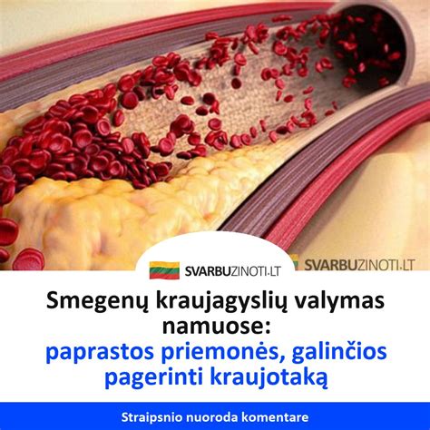 Smegenų kraujagyslių tinklas