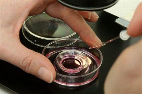 istorinis dirbtinio apvaisinimo prietaisas