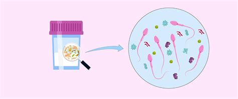 Spermos kelionės schema