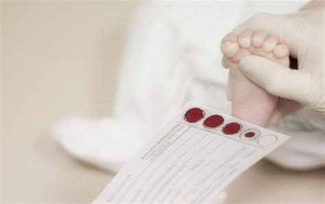 Gydytojas atlieka naujagimio kraujo tyrimą